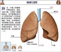 波爾山羊肺炎