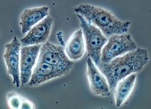 海拉細胞