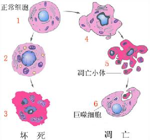 細胞凋亡與細胞壞死的區別