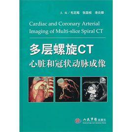 多層螺旋CT心臟和冠狀動脈成像