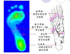 足壓圖與足骨跟對照表