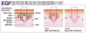 表皮因子