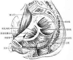 盆腔積液