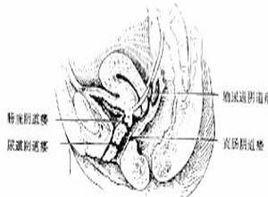 便稀時經陰道排出