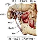 假性顳下頜關節強硬