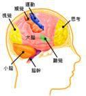 假性延髓麻痹