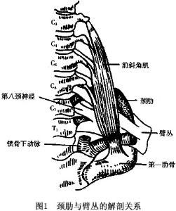 頸肋