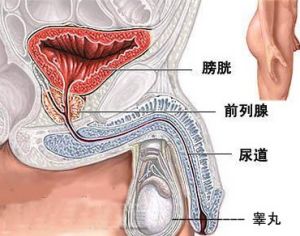 膀胱癌