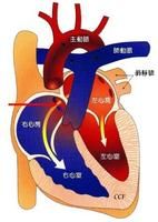 心肌細胞