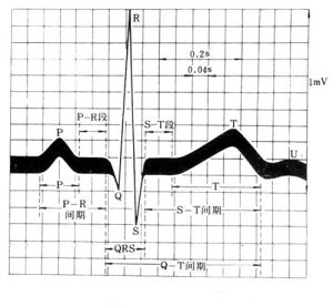 心電圖指標解釋