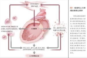 收縮性心力衰竭