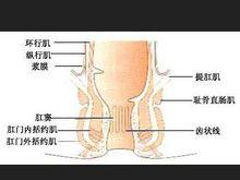 肛門外括約肌斷裂