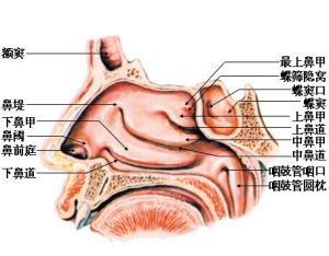 肥厚性鼻炎