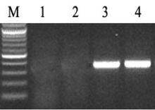 土壤DNA soil DNA