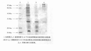 胃蛋白酶提取膠原蛋白的電泳圖譜