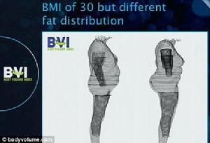 3D脂肪掃瞄器