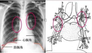 疾病檢查