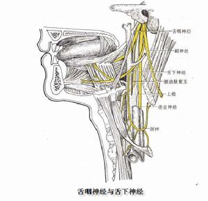 舌咽神經痛