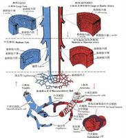 交換血管