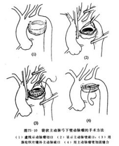 （圖）治療手段