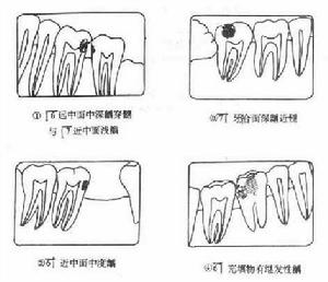 口腔頜面部損傷