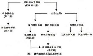 鐮狀細胞貧血視網膜病變