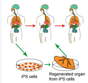 利用再生醫學手段，將受損之肺臟以iPS細胞所形成之臟器組織進行再生。