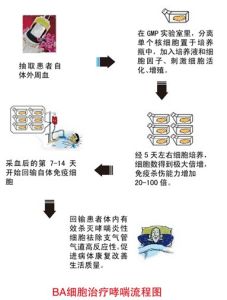 BA標準化哮喘治療體系