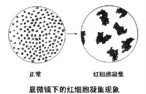 細胞凝集反應