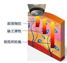 熱拉提