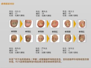 科蕊產品前後使用對比圖