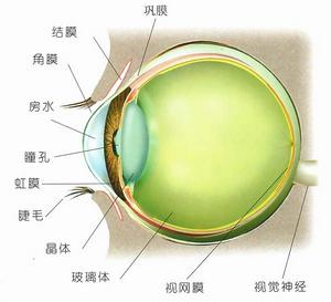 血影細胞性青光眼