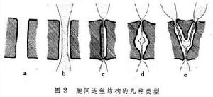 胞間連絲