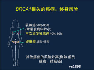 卵巢癌易感基因檢測