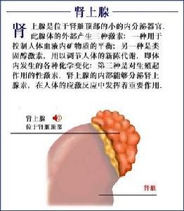 高血鉀型腎小管性酸中毒