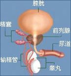 前列腺增生