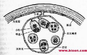 肝多房棘球絛蟲感染