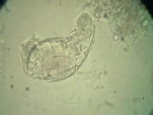 輪蟲Rotifer