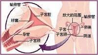 排卵性月經失調