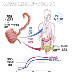 功能性胃腸病