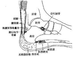 足跟效應