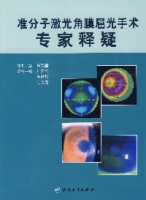 準分子雷射角膜屈光手術專家釋疑