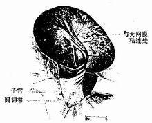 己烯雌酚 不良反應