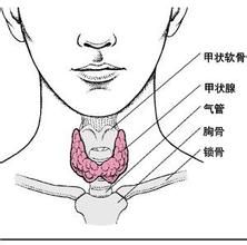 亞急性甲狀腺炎