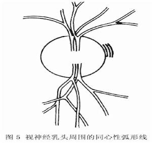 視神經乳頭水腫及視盤水腫