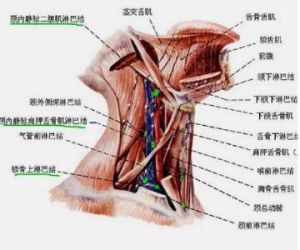 淋巴結腫