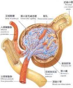 腎小管性酸中毒