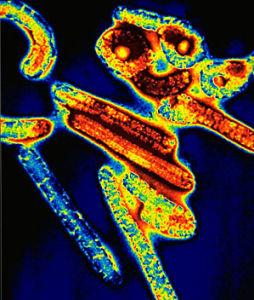 （圖）伊波拉出血熱