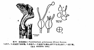 膠質刺銀耳