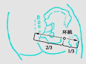 （圖）傳統定位法